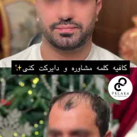 کلینیک ترمیم مو ریخته شده و پروتز اقایان اراک