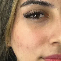 کاشت تخصصی هیدن لیفت ابرو و مژه|خدمات آرایشگری و زیبایی|لاهیجان, مهرگان|دیوار