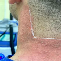 کلینیک لیزر و زیبایی سولنزا