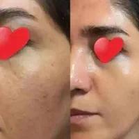 کرم گلدن شاین طلایی اصلی گلدن کویین|آرایشی، بهداشتی، درمانی|شیراز, شهرک ولیعصر|دیوار