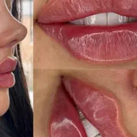 آموزش ژل فیلر لب چانه انزیم چاقی صورت مزو مو فشیال|خدمات آرایشگری و زیبایی|قم, زنبیل آباد|دیوار