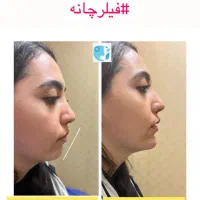 کلینیک پوست و مو و لیزر و زیبایی در اسلامشهر|خدمات آرایشگری و زیبایی|اسلام‌شهر, باغ فیض|دیوار