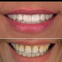 دندانپزشکی ستارخان اقساط ایمپلنت کامپوزیت عصبکشی|خدمات آرایشگری و زیبایی|تهران, صادقیه|دیوار