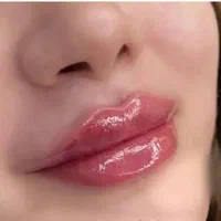 جشنواره تزریق بوتاکس ژل مزوجوانساز مادلینگ درمطب