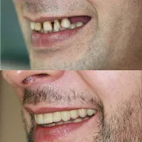 اقساط دندانپزشکی بدون پرداخت پول کلیه خدمات|خدمات آرایشگری و زیبایی|اصفهان, دشتستان|دیوار