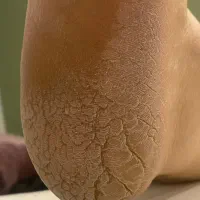 اموزش تخصصی پدیکور اسمارت مجازی و حضوری|خدمات آموزشی|یزد, |دیوار