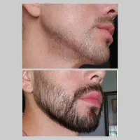 25 روزه ریشاتو تکمیل کن