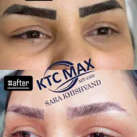 تخفیفات یلدایی ریموو تاتو /آرایش دائم|خدمات آرایشگری و زیبایی|سمنان, |دیوار