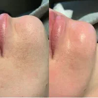 50% تخفیف خدمات تخصصی پوست و مو ۲۹۸|خدمات آرایشگری و زیبایی|مشهد, آزادشهر|دیوار