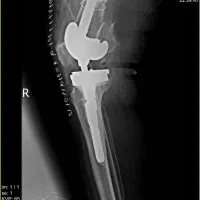 منشی خانوم ارتوپدی