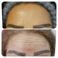 بوتاکس ، ژل و مزوتراپی و لیزر و کلیه خدمات زیبایی|خدمات آرایشگری و زیبایی|بومهن, |دیوار