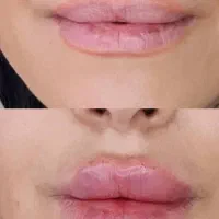 ژل لب گونه چونه زاویه خدمات پرسینگ|خدمات آرایشگری و زیبایی|صدرا-فارس, فاز ۱|دیوار