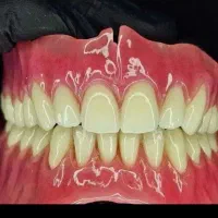 لابراتور دندانسازی