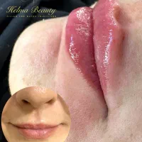 تزریق ژل و بوتاکس و انزیم و مزوجوانساز.|خدمات آرایشگری و زیبایی|پاکدشت, شهرک امام رضا|دیوار