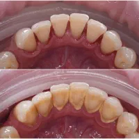 تخفیف خدمات دندانپزشکی|خدمات آرایشگری و زیبایی|رشت, گلسار|دیوار