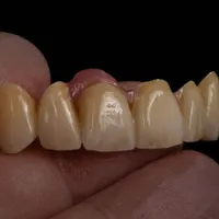 پودرگذار و کارآموز مسلط به قالبریزی درلابراتوار|استخدام درمانی، زیبایی، بهداشتی|تبریز, |دیوار