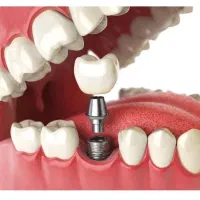 دندانپزشکی دکتر هدیه هدایت زاده