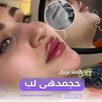 ادیت محتوا اینستاگرام|خدمات رایانه‌ای و موبایل|تهران, چیتگر جنوبی|دیوار