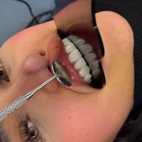 بیا ساری خاص ترین کامپوزیت انجام بده