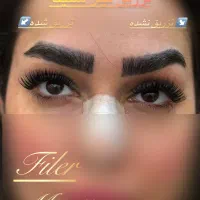 تزریق فیلر صورت مطابق المانهای زیبایی شناسی|خدمات آرایشگری و زیبایی|قرچک, پویینک|دیوار