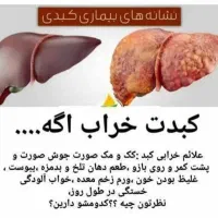 پاکسازی و کنترل کبد چرب|خدمات آرایشگری و زیبایی|سمیرم, |دیوار