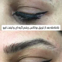 تزریق بوتاکس و فیلر|خدمات آرایشگری و زیبایی|رشت, خواهر امام|دیوار