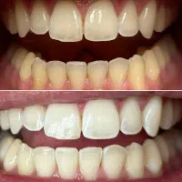 کلیه خدمات دندانپزشکی
