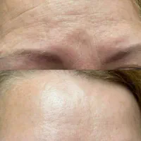 کرم رفع کننده چین و چروک ایتالیایی + پرداخت امن