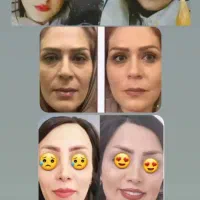 پودر جوانه گندم تپلی صورت|خوردنی و آشامیدنی|تهران, هلال احمر|دیوار