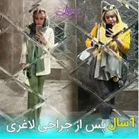 جراحی عمل اسلیومعده/اسلیو معده/چاقی لاغری/اسلیو|خدمات آرایشگری و زیبایی|تهران, چیتگر جنوبی|دیوار