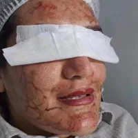 پاکسازی تخصصی درمانی پوست و ماساژصورت وبدن|خدمات آرایشگری و زیبایی|تربت‌حیدریه, نواب صفوی|دیوار