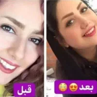 پوست ومو|آرایشی، بهداشتی، درمانی|قم, قم نو|دیوار
