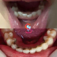 کاشت ایمپلنت و خدمات درمانی و زیبایی دندانپزشکی