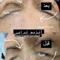 فیشال داخل کیلینیک وسالن زیبایی|خدمات آرایشگری و زیبایی|قم, صدوق|دیوار