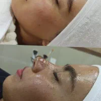فیشال تخصصی در کلینیک