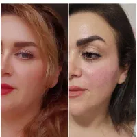 خدمات و آموزش تخصصی ژل و بوتاکس|خدمات آرایشگری و زیبایی|کرج, کیانمهر|دیوار
