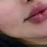 تزریق ژل و بوتاکس|خدمات آرایشگری و زیبایی|اهواز, نادری|دیوار