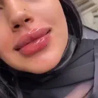 جشنواره ژل لب فیلر زیرچشم بوتاکس،prp،کلینیک معتبر|خدمات آرایشگری و زیبایی|کرج, گوهردشت|دیوار
