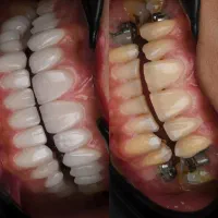 دستیار دندانپزشکی