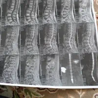طب سنتی حجامت قاروق