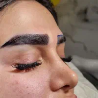 میکروکاشت ابرو با و بدون جراحی و کاشت مو