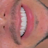 دندانپزشکی|خدمات آرایشگری و زیبایی|کوهدشت, |دیوار