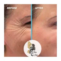 زیبایی ماندگار با خدمات تخصصی ژل و بوتاکس|خدمات آرایشگری و زیبایی|صدرا-فارس, فاز ۱|دیوار