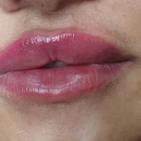 تخفیفات زیبایی و عملهای جراحی|خدمات آرایشگری و زیبایی|دوگنبدان, |دیوار