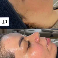 فیشیال تخصصی پوست