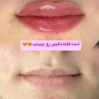 کلینیک زیبای و جراحی|خدمات آرایشگری و زیبایی|بندر گناوه, |دیوار