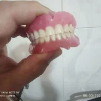 ساخت انواع دندان های مصنوعی متحرک و لثه ژله ای|آرایشی، بهداشتی، درمانی|شیراز, اصلاحنژاد|دیوار