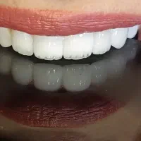 دندانپزشکی بیمه تامین اجتماعی کمیته امدادوبهزیستی