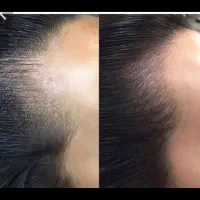 اسکالپ سر|خدمات آرایشگری و زیبایی|گرگان, |دیوار