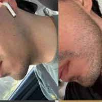 در کمتر از ۳۰ روز ریشاتو بساز